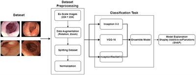 Explainable AI-driven model for gastrointestinal cancer classification